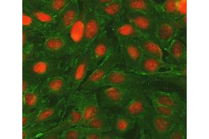 IF analysis of BCL2 and Tubulin alpha using anti-BCL2 antibody (ABIN5693065) and anti-Tubulin alpha antibody (ABIN7600339). (Bcl-2 Antikörper  (AA 118-165))