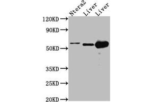 Western Blot Positive WB detected in: Ntera-2 whole cell lysate, Mouse Liver whole cell lysate, Rat Liver cell lysate All lanes: ALDH2 antibody at 1:1000 Secondary Goat polyclonal to rabbit IgG at 1/50000 dilution Predicted band size: 57, 51 kDa Observed band size: 57 kDa (Rekombinanter ALDH2 Antikörper)