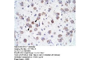 Human Brain (Raly Antikörper  (N-Term))