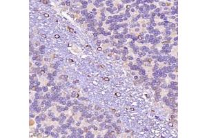 Immunohistochemistry (Paraffin-embedded Sections) (IHC (p)) image for anti-Neuregulin 2 (NRG2) antibody (ABIN7074804)