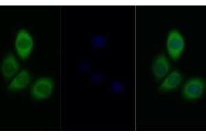Detection of INSR in Human MCF7 cell using Polyclonal Antibody to Insulin Receptor (INSR) (Insulin Receptor Antikörper  (AA 1101-1372))