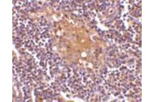 Immunohistochemistry (Paraffin-embedded Sections) (IHC (p)) image for anti-CD5 Molecule-Like (CD5L) (C-Term) antibody (ABIN499245)