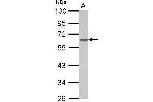 WB Image Sample (30 ug of whole cell lysate) A: A431 10% SDS PAGE antibody diluted at 1:1000 (BIN1 Antikörper)