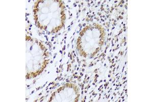 Immunohistochemistry of paraffin-embedded human appendix using Phospho-c-Abl-Y412 antibody (ABIN7265966) at dilution of 1:100 (40x lens).