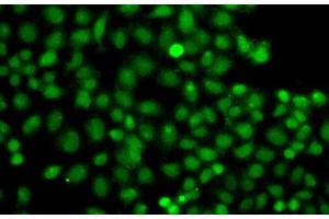 Immunofluorescence analysis of A549 cells using PIP5K1A Polyclonal Antibody