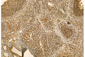 ABIN6264546 and ABIN6272948 at 1/100 staining Rat ovary tissue by IHC-P. (QSOX1 Antikörper  (Internal Region))