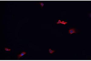 ABIN6268970 staining HeLa? (Dematin Antikörper  (pSer403))