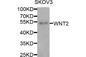 Western blot analysis of extracts of SKOV3 cells, using WNT2 antibody. (WNT2 Antikörper)