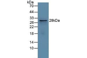 Detection of Recombinant GCLM, Human using Polyclonal Antibody to Glutamate Cysteine Ligase, Modifier Subunit (GCLM) (GCLM Antikörper  (AA 40-251))