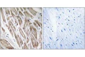Immunohistochemistry (IHC) image for anti-NADH Dehydrogenase (Ubiquinone) Fe-S Protein 5, 15kDa (NADH-Coenzyme Q Reductase) (NDUFS5) (AA 57-106) antibody (ABIN1535066)