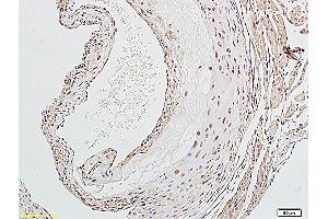 Formalin-fixed and paraffin embedded rat aorta labeled with Anti-LOX-1 Polyclonal Antibody, Unconjugated (ABIN676988) followed by conjugation to the secondary antibody and DAB staining (OLR1 Antikörper  (AA 201-273))