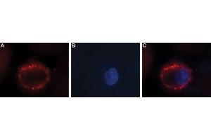 Expression of FSH receptor in human ovary cell line - Cell surface detection of FSH receptor in intact living human OVCAR3 cells. (FSHR Antikörper  (Extracellular))