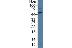 Detection of vWA1 in Rat Testis lysate using Polyclonal Antibody to Von Willebrand Factor A Domain Containing Protein 1 (vWA1) (VWA1 Antikörper  (AA 42-289))