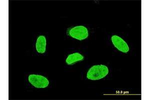 Immunofluorescence of monoclonal antibody to TBX3 on HeLa cell. (TBX3 Antikörper  (AA 311-410))