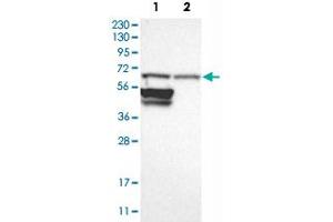 Western Blot analysis of Lane 1: RT-4 and Lane 2: U-251 MG sp cell lysates with RPN2 polyclonal antibody . (Ribophorin II Antikörper)