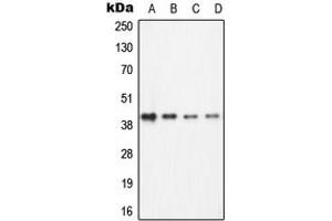 Western blot analysis of ECA39 expression in Jurkat (A), Ramos (B), NIH3T3 (C), PC12 (D) whole cell lysates. (BCAT1 Antikörper  (C-Term))