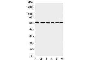 Western blot testing of Apoptosis-Inducing Factor antibody and Lane 1:  rat heart (AIF Antikörper  (C-Term))