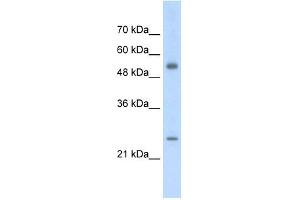AK3L1 antibody used at 2. (AK4 Antikörper  (Middle Region))