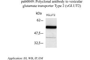 Image no. 1 for anti-Solute Carrier Family 17 (Vesicular Glutamate Transporter), Member 6 (SLC17A6) (C-Term) antibody (ABIN346996) (Solute Carrier Family 17 (Vesicular Glutamate Transporter), Member 6 (SLC17A6) (C-Term) Antikörper)