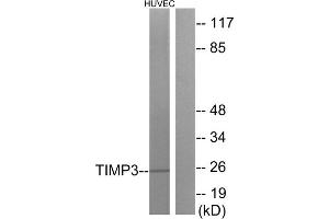 Western blot analysis of extracts from HUVEC cells, using TIMP3 antibody. (TIMP3 Antikörper  (Internal Region))