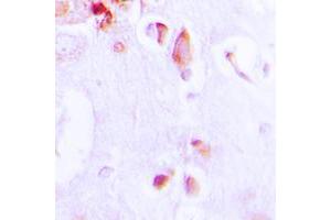 Immunohistochemical analysis of ARRDC3 staining in human brain formalin fixed paraffin embedded tissue section. (ARRDC3 Antikörper  (C-Term))