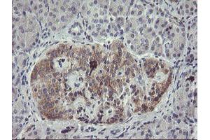 Immunohistochemical staining of paraffin-embedded Human pancreas tissue using anti-EIF5A2 mouse monoclonal antibody. (EIF5A2 Antikörper)