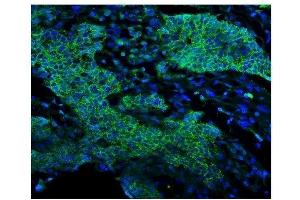 IF analysis of EGFR using anti-EGFR antibody (ABIN7601478). (EGFR Antikörper  (AA 36-497))