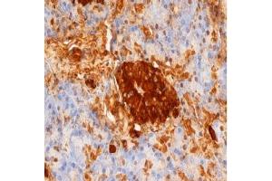 Staining of paraffin embedded human pancreas with mouse anti rat Insulin. (Insulin Antikörper)