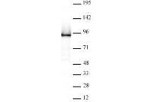 Rad21 antibody (rAb) tested by Western blot. (Rekombinanter RAD21 Antikörper  (N-Term))
