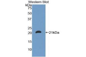 Western blot analysis of the recombinant protein. (CD8B Antikörper  (AA 22-170))