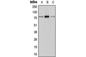 Western blot analysis of CNT1 expression in HEK293T (A), mouse brain (B), H9C2 (C) whole cell lysates. (SLC28A1 Antikörper  (Center))