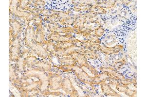 ABIN7094606 and ABIN7098656 at 1/100 staining Rat kidney tissue by IHC-P. (SPTA1 Antikörper  (C-Term))