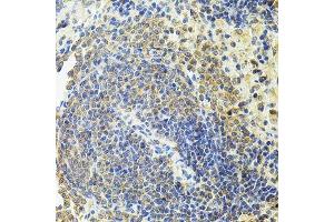 Immunohistochemistry of paraffin-embedded rat spleen using RALBP1 antibody. (RALBP1 Antikörper  (AA 396-655))