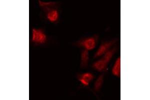 ABIN6268928 staining 293 by IF/ICC. (Caspase 6 Antikörper  (Cleaved-Asp179))