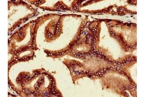 Immunohistochemistry (IHC) image for anti-Myc Proto-Oncogene protein (MYC) (AA 16-454) antibody (ABIN7160384)