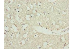Immunohistochemistry of paraffin-embedded human brain tissue using ABIN7176197 at dilution of 1:100 (ZNF264 Antikörper  (AA 1-220))