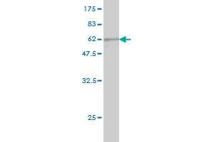Western Blot detection against Immunogen (57. (PIH1D1 Antikörper  (AA 1-290))