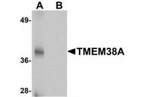 Western blot analysis of TMEM38A in rat skeletal muscle tissue lysate with TMEM38A antibody at 1 μg/mL in (A) the absence and (B) the presence of blocking peptide. (TMEM38A Antikörper  (C-Term))