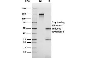 SDS-PAGE Analysis Purified FABP2 Mouse Monoclonal Antibody (CPTC-FABP2-3). (FABP2 Antikörper)