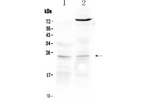 Western blot analysis of TIMP3 using anti- TIMP3 antibody .