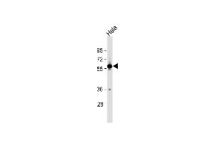 Anti-SLC30A1 Antibody (C-term) at 1:1000 dilution + Hela whole cell lysate Lysates/proteins at 20 μg per lane. (SLC30A1 Antikörper  (C-Term))