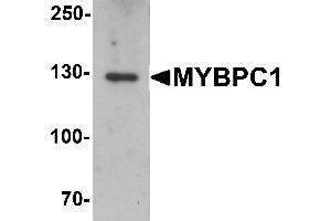 Western blot analysis of MYBPC1 in rat skeletal muscle tissue lysate with MYBPC1 antibody at 1 µg/mL. (MYBPC1 Antikörper  (N-Term))
