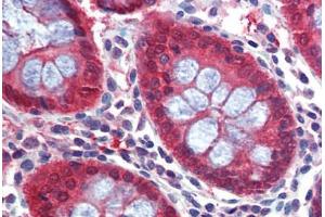 Human Colon: Formalin-Fixed, Paraffin-Embedded (FFPE) (Caspase 7 Antikörper  (C-Term))