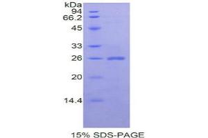 SDS-PAGE analysis of Mouse CLCF1 Protein. (CLCF1 Protein)