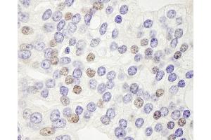 Immunohistochemistry (IHC) image for anti-DEK Oncogene (DEK) (AA 225-275) antibody (ABIN7448525) (DEK Antikörper  (AA 225-275))