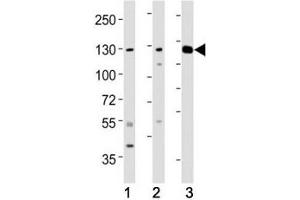 Western Blotting (WB) image for anti-Receptor Tyrosine Kinase-Like Orphan Receptor 1 (ROR1) antibody (ABIN3032439)