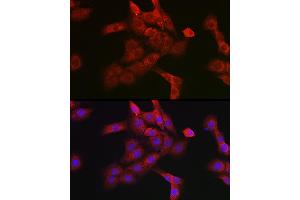 Immunofluorescence analysis of PC-12 cells using Cathepsin B Rabbit pAb (ABIN3021175, ABIN3021176, ABIN3021177 and ABIN6214050) at dilution of 1:100 (40x lens). (Cathepsin B Antikörper  (AA 1-339))