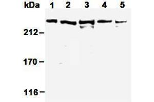 Western Blotting (WB) image for anti-Nuclear Mitotic Apparatus Protein 1 (NUMA1) antibody (ABIN1449239)