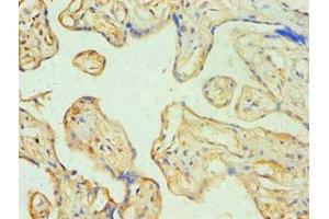 Immunohistochemistry of paraffin-embedded human placenta tissue using ABIN7170774 at dilution of 1:100 (SOAT1 Antikörper  (AA 1-130))