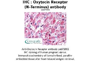 Image no. 1 for anti-Oxytocin Receptor (OXTR) (Extracellular Domain), (N-Term) antibody (ABIN1737740) (Oxytocin Receptor Antikörper  (Extracellular Domain, N-Term))